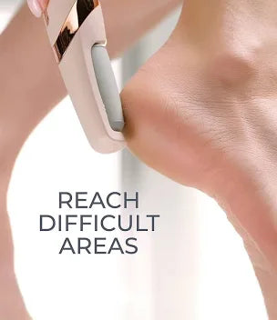 Bos Medicare Surgical Finishing Touch Flawless Pedi Electronic Tool File and Callus Remover, Foot File Callus Remover Too